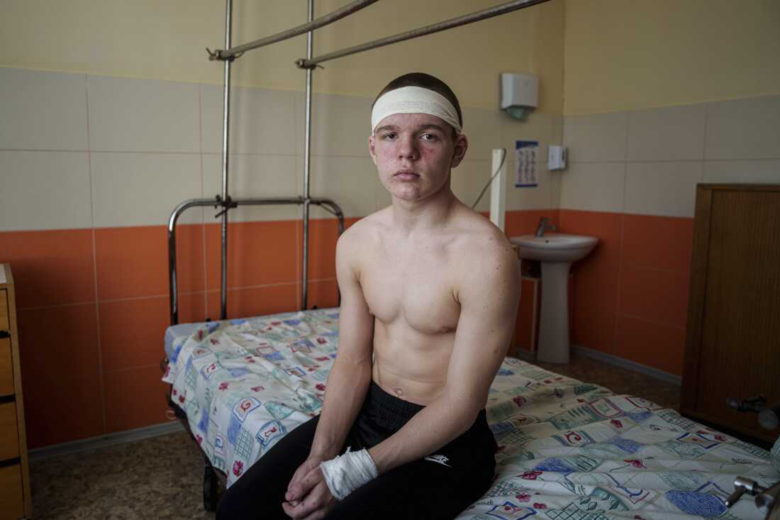 Kyrylo Illiashenko, 13, sits on a hospital bed, Mon., April 14, 2025, after being injured on Sunday by a Russian missile strike on Sumy, Ukraine, while trying to help others evacuate a burning bus that he later exited through a shattered window.